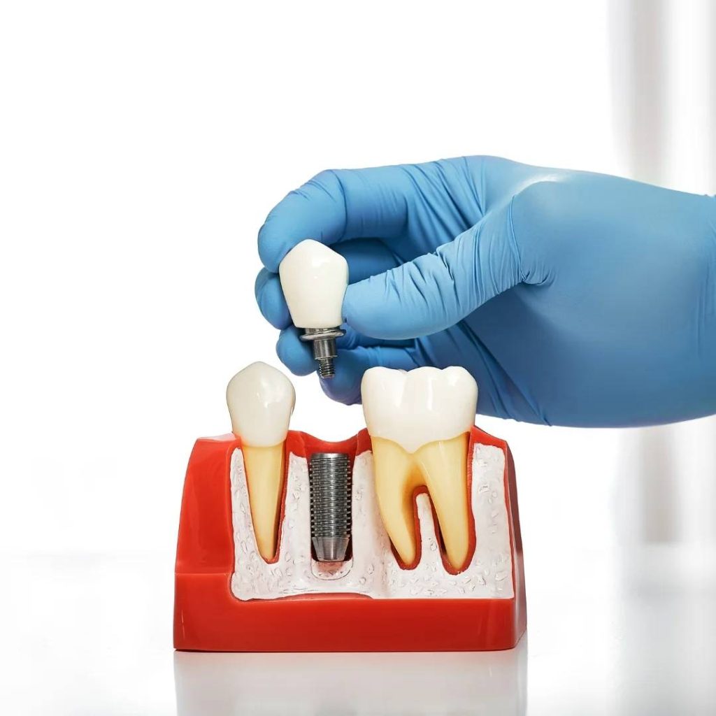 restorative dentistry London Ontario