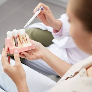 dental implants London Ontario London, ON