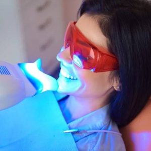 professional teeth whitening in London