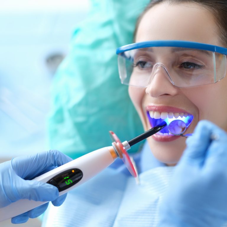 Dentist curing a tooth-coloured filling with a blue light